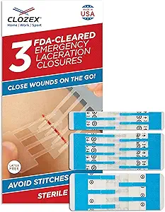 Repair wounds without stiches